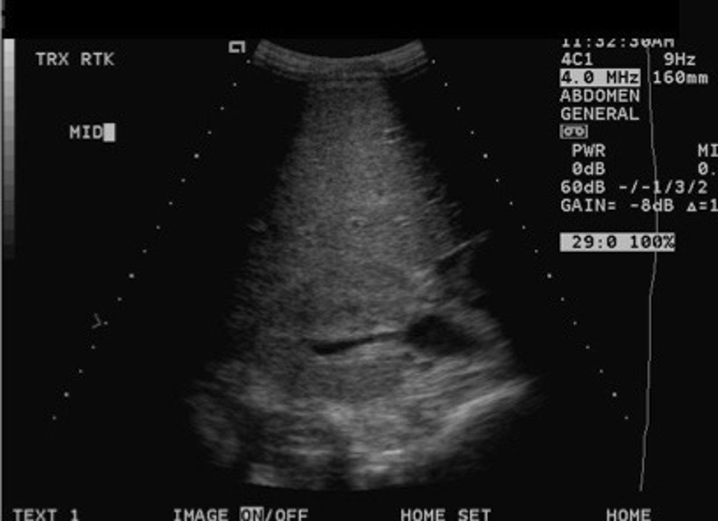 <p>What does this image show</p>