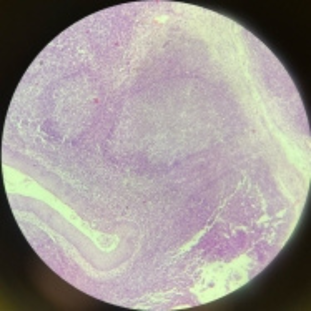 term image