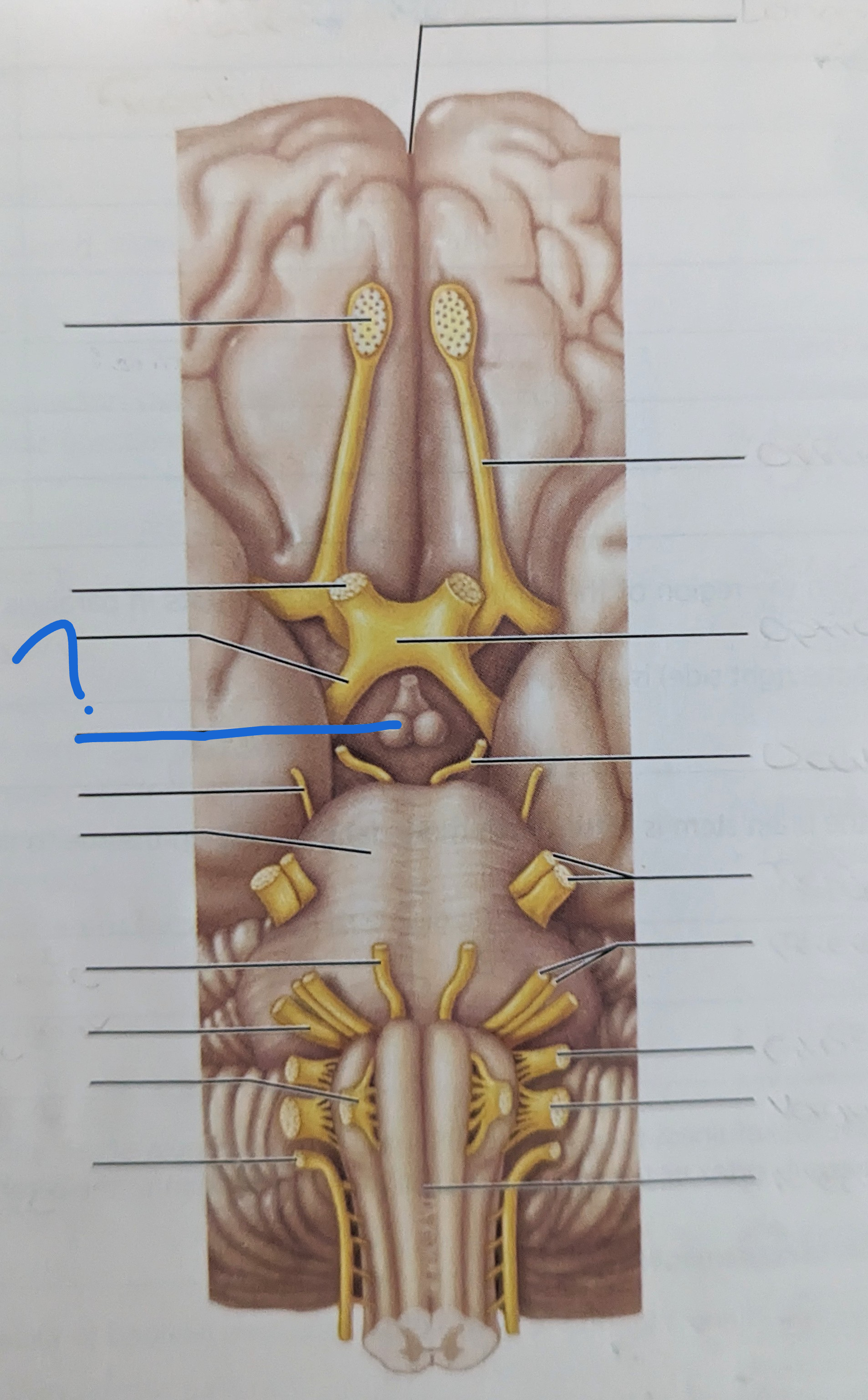 <p>What is the name of this?</p>