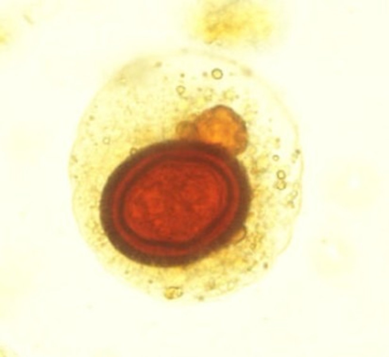 <p>Identify the parasite</p>