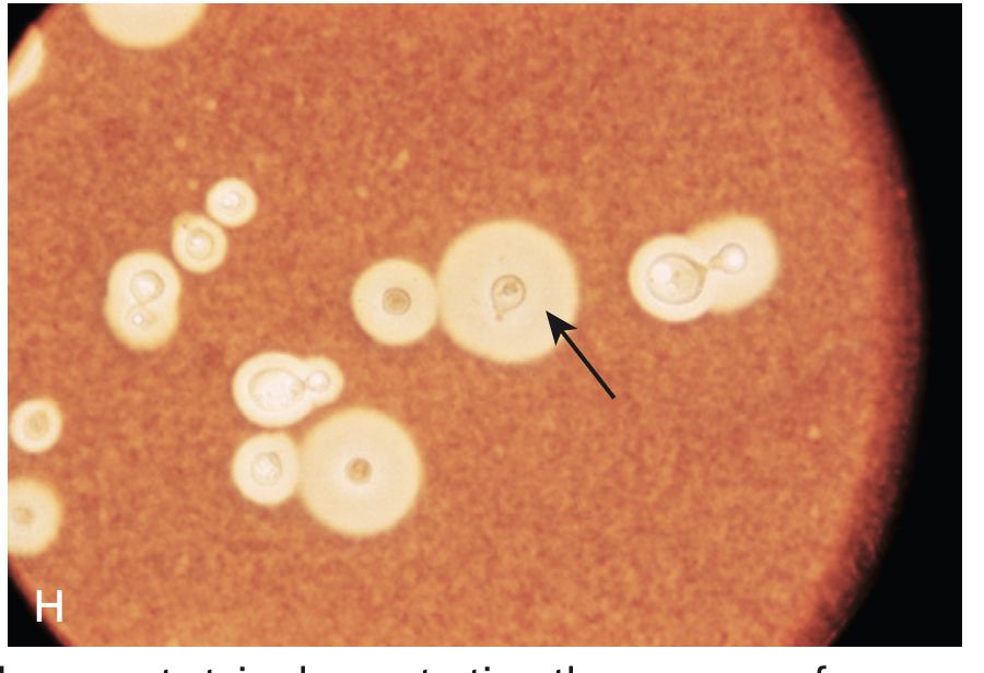 <p>An encapsulated yeast that can cause cryptococcosis.</p>