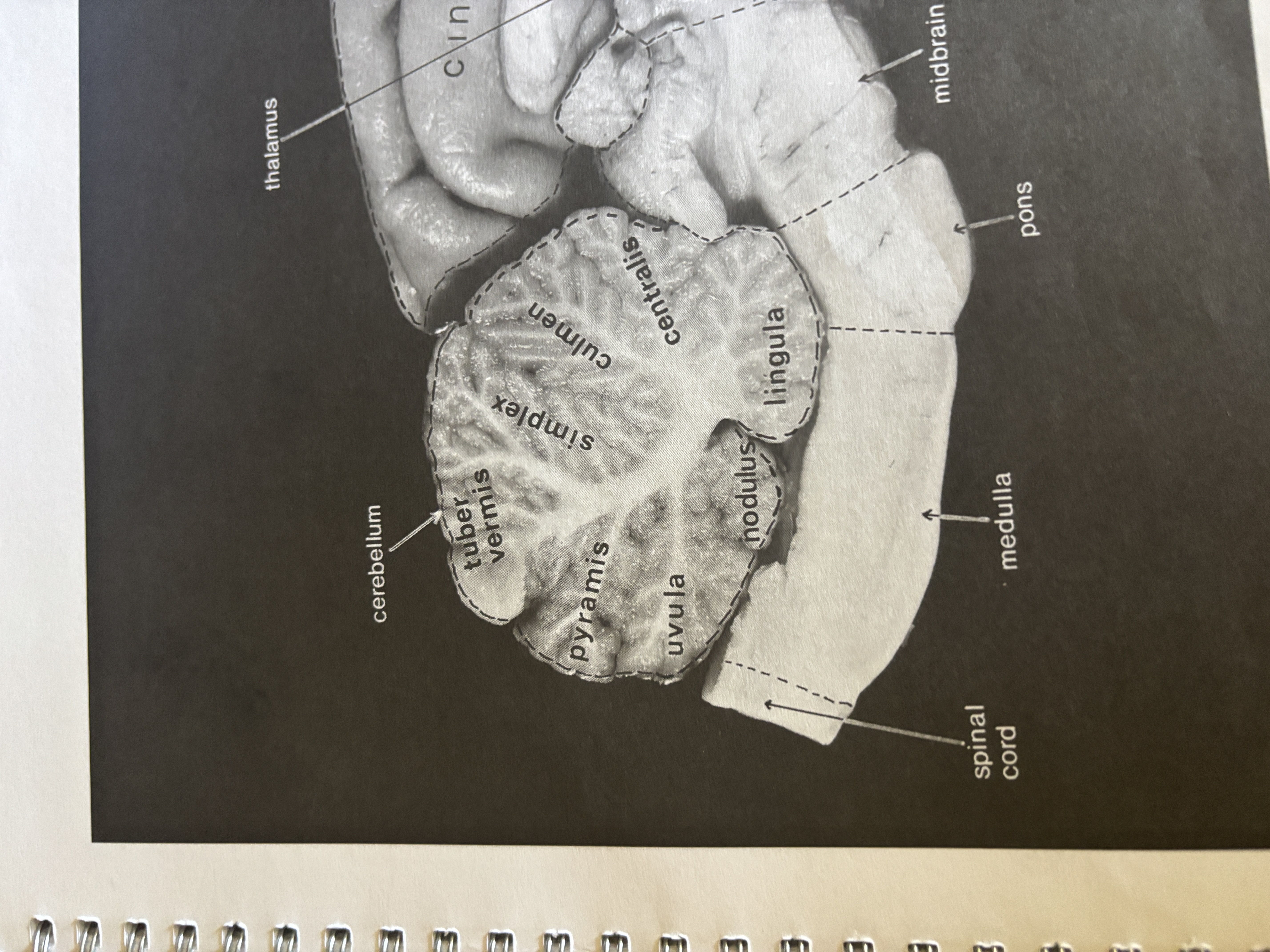 <p>Nodulus</p>