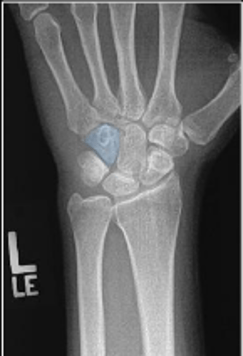 <p>What is outlined?</p>