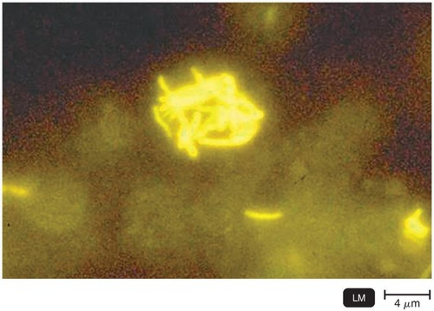 <p>Fluorescence microscopy uses UV light to excite fluorescent substances that emit visible light.</p>