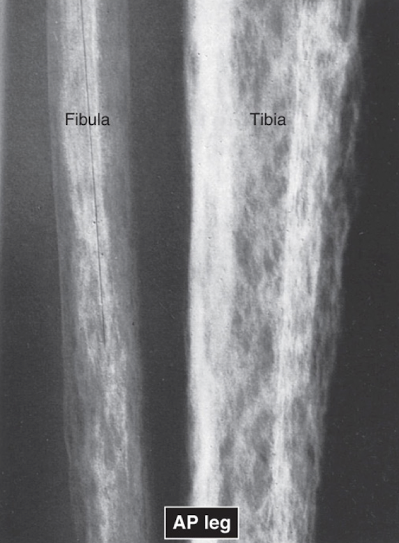 <p>Textural Abnormalities:</p><ul><li><p>Assess the ___ for abnormalities </p></li></ul><p></p>