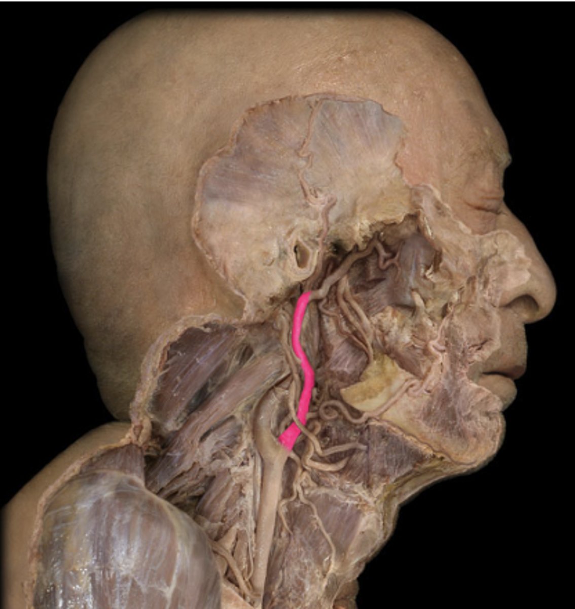 <p>Generally supplies blood to the face, mouth, sinuses and structures of the lateral head</p>