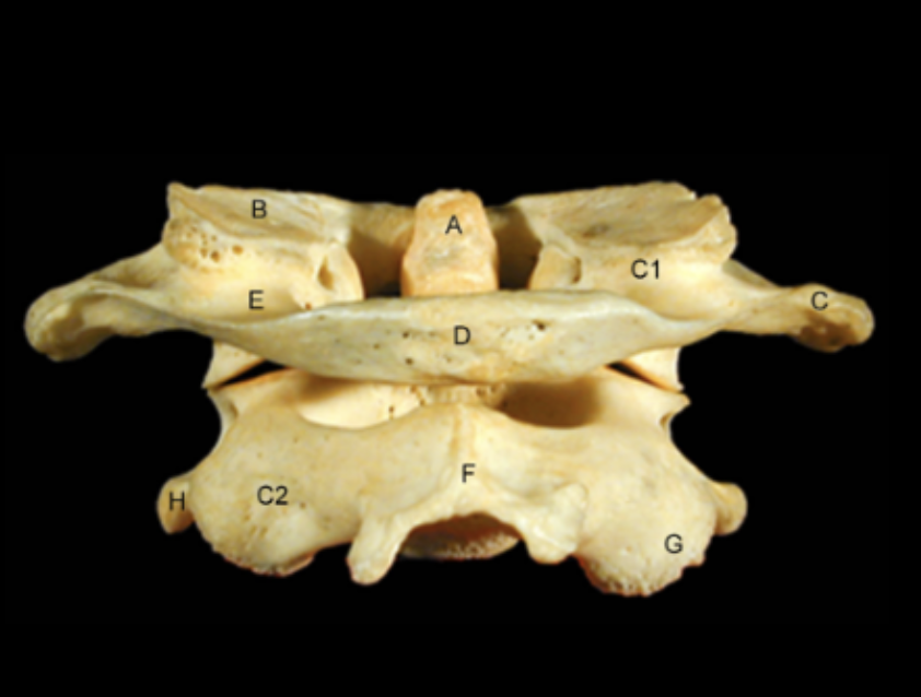 <p>Identify the Structures of the Cervical Vertebrae - Posterior View</p>