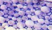 <p>Variation of angular type, spherical/oval cells, small intercellular spaces, in fruit walls</p>
