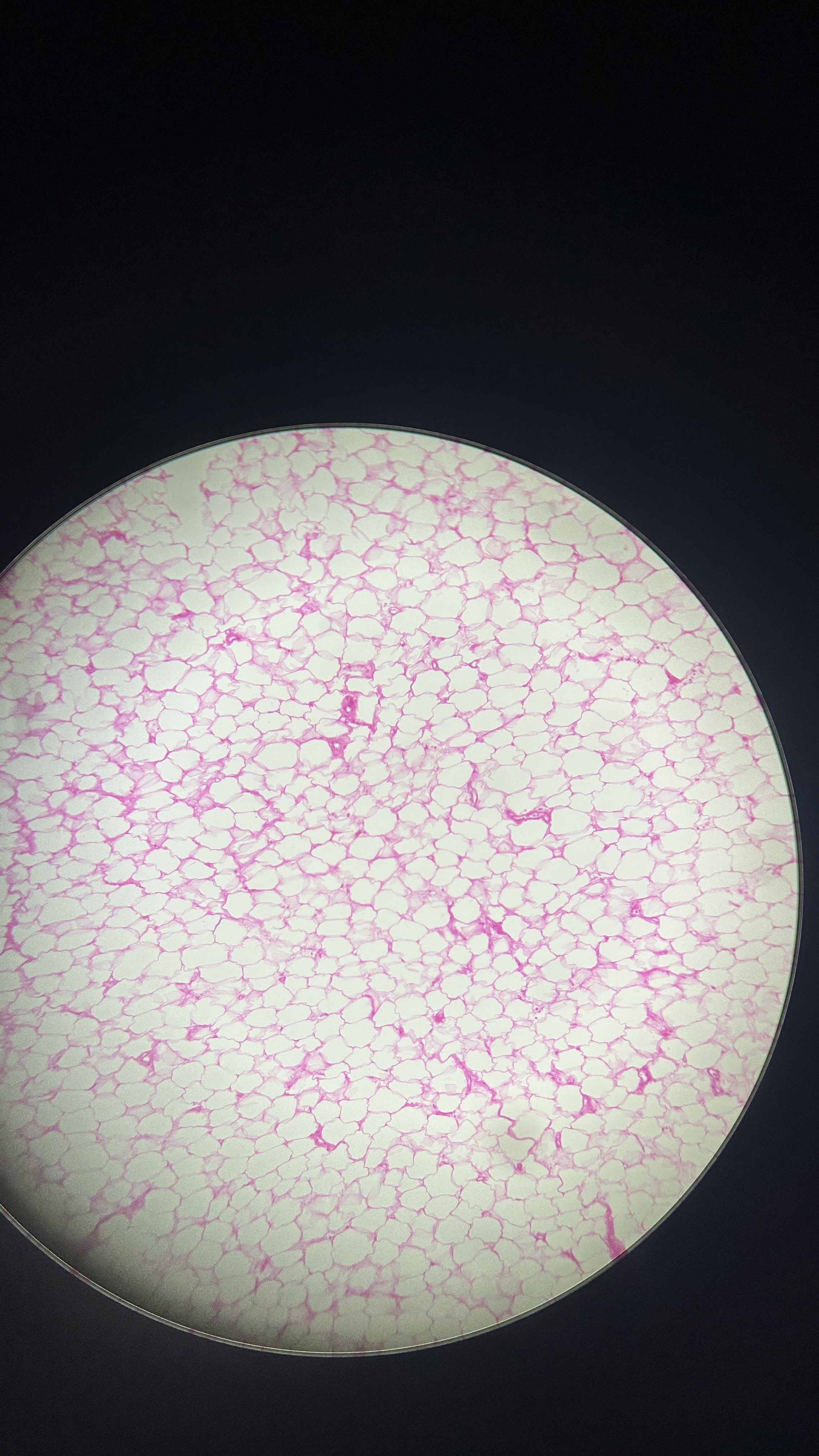 <p>What is the magnification level of the Adipose Tissue?</p>