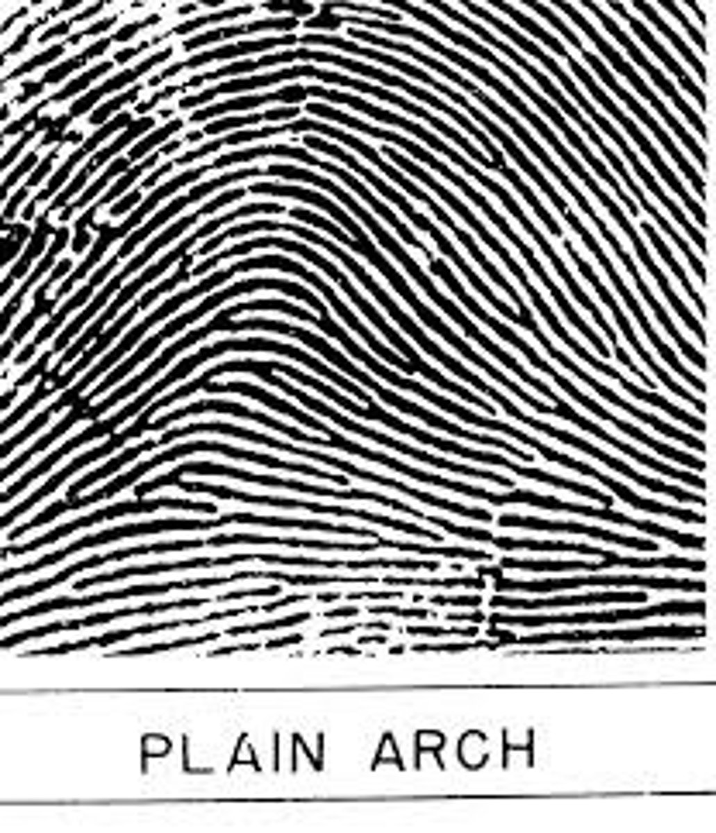 <p>Ridges flow smoothly with a gentle rise in the center</p>