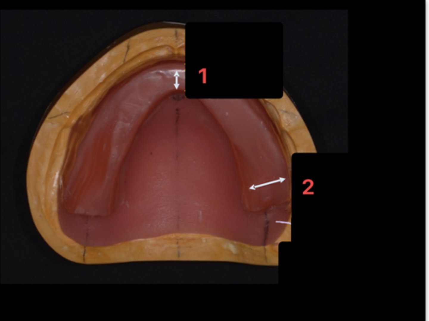 <p>For the CD comp, what were the measurements for the posterior teeth section on the wax rim (#2 in image)?</p>