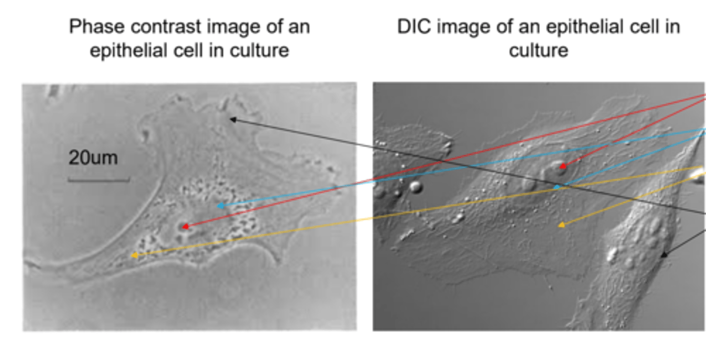 <p>DIC generates a 3D appearing image; almost appearing metallic</p>