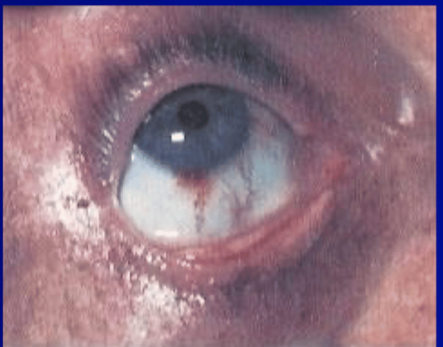 <p>conjunctiva</p><p>mouth</p><p>upper extremity</p>