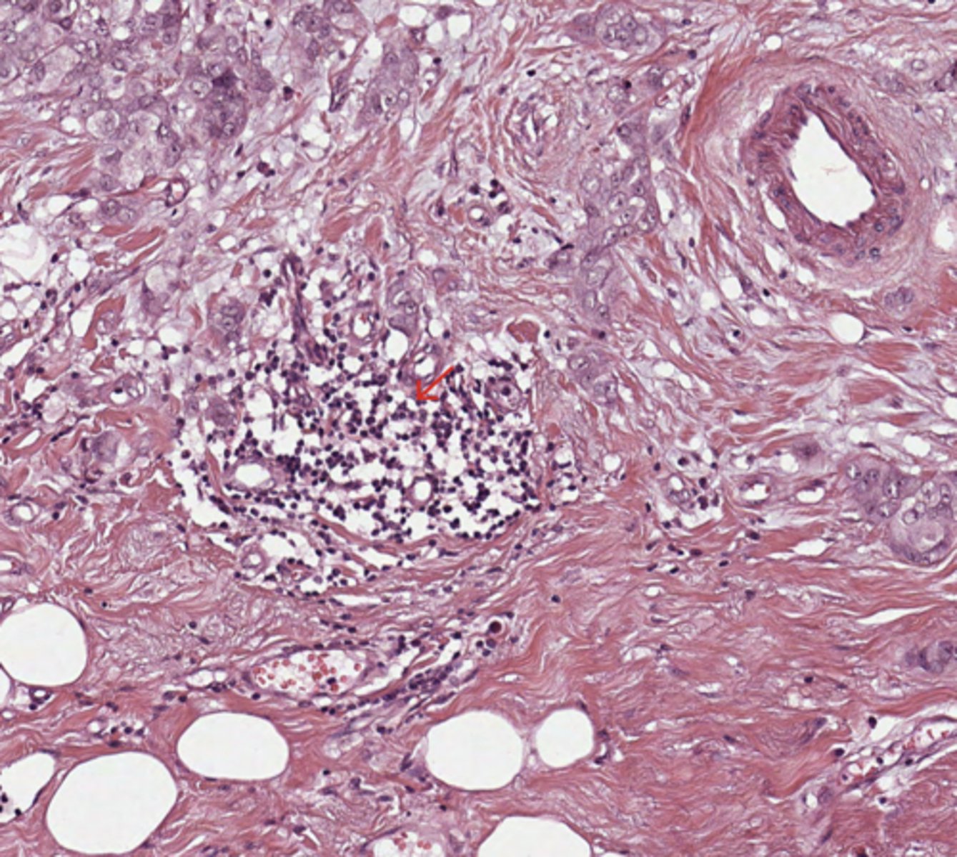 <p>breast</p>