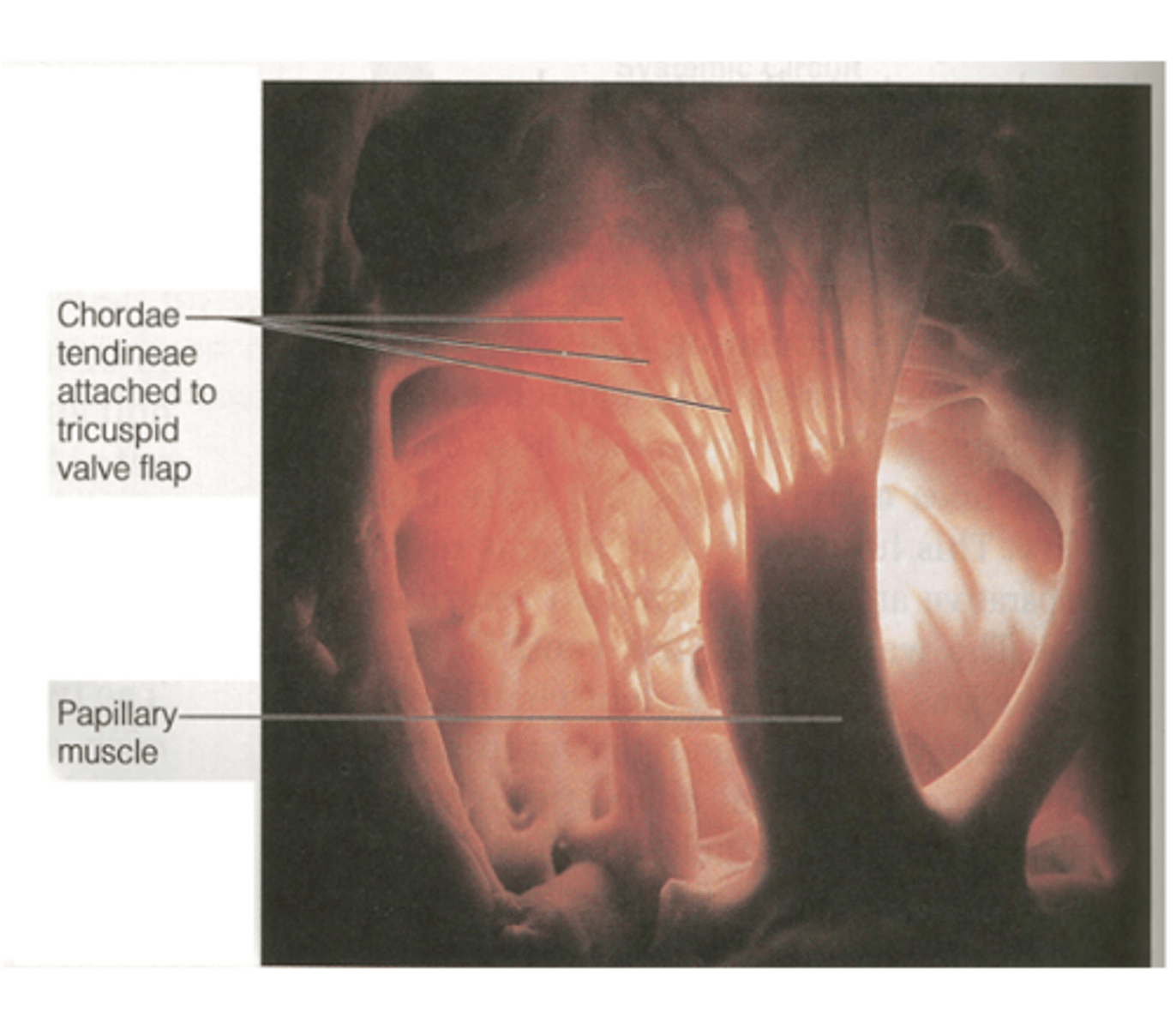 <p>elastic cords inserted into the papillary muscles composed of what type of tissue? </p>