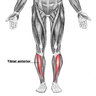 <p>Tibialis anterior</p>