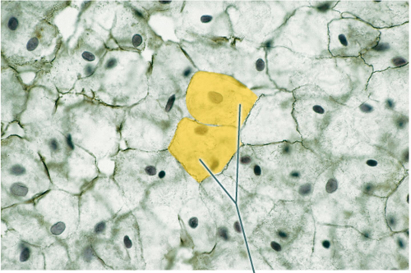 <p>flattened and scale-like</p>