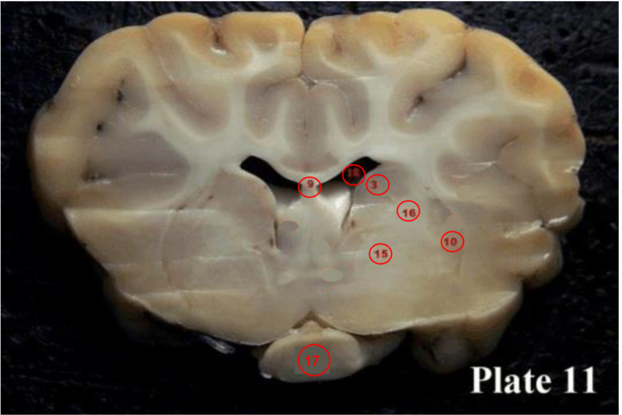 <p>Internal capsule</p>