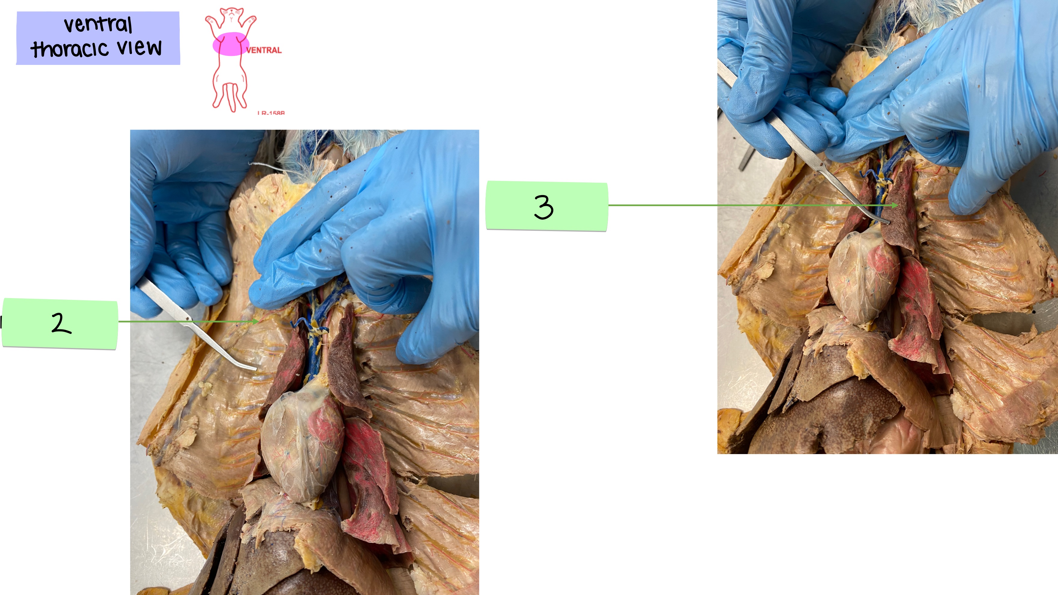 <p>parietal pleura</p>