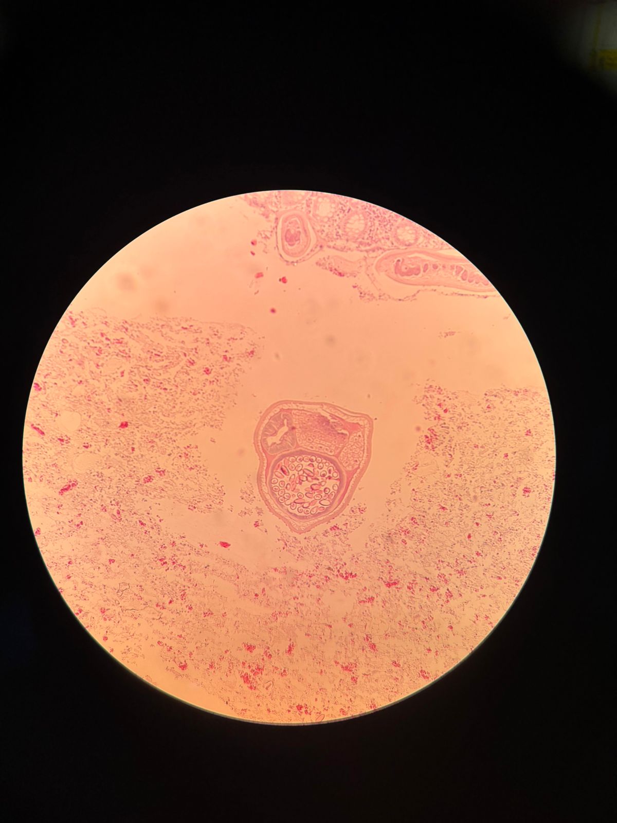 term image