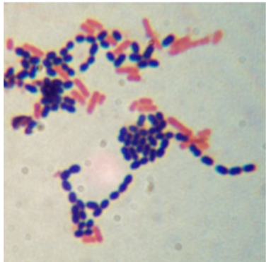 <p>Can you identify the groups of bacteria present in this image, based on Gram stain?</p>