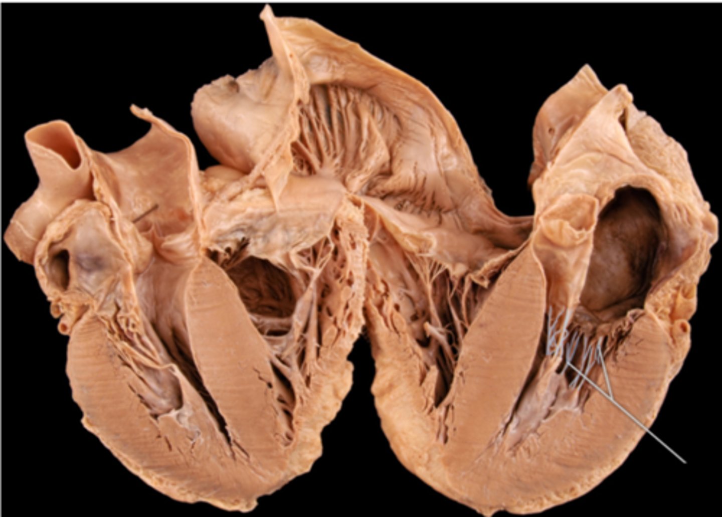 <p>chordae tendineae</p>