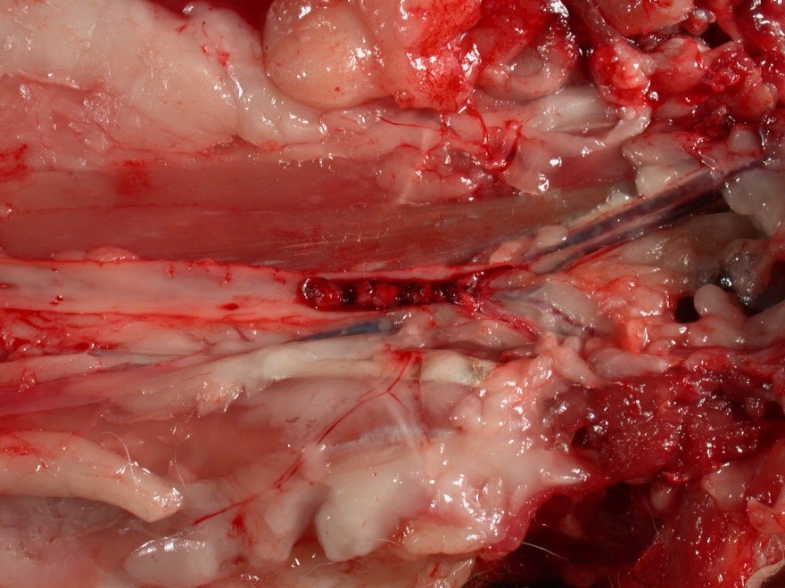 <p>The image shows a thrombus at the aortic bifurcation (“saddle thrombus”) in a cat with hypertrophic cardiomyopathy. What type of hypoxia would result from this thrombus?</p><p></p><p>Hypoglycemic hypoxia</p><p>&nbsp;</p><p>Anemic hypoxia</p><p>&nbsp;</p><p>Ischemic hypoxia</p>