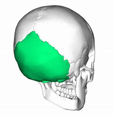 <p>What cranial bone is this?</p>