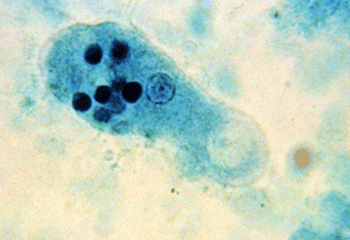 <p>Identify the organism and stage</p>