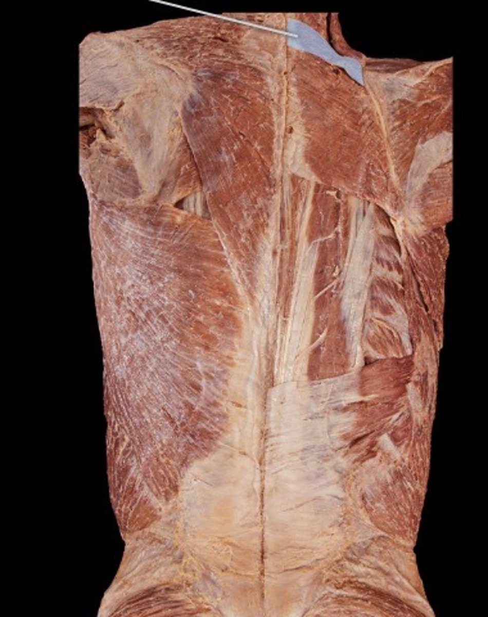 <p>What muscle is this?</p>