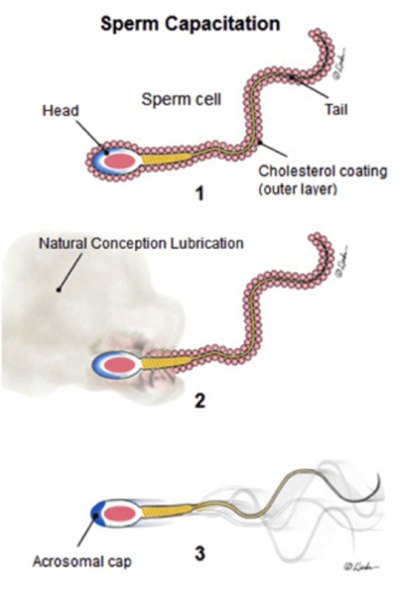 <p>Thinning of plasma membrane -&gt; acrosomal cap</p>