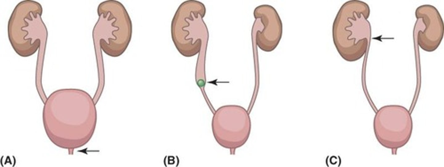 <p>Process of creating urine from glomerular filtrate.</p>