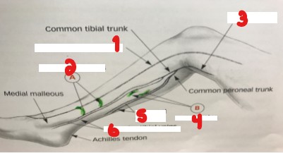 <p>Label the veins on this image. </p>