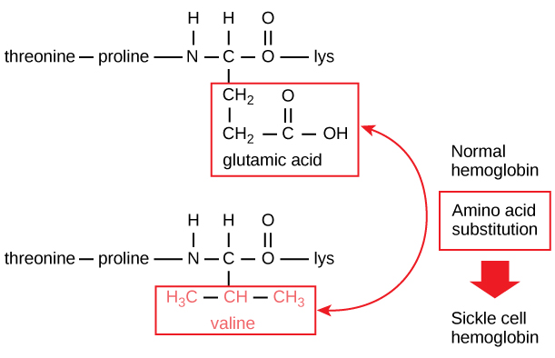 <p>Image: In this condition, <span>glutamic acid, the sixth amino acid in the hemoglobin β chain, is replaced by valine.</span></p>
