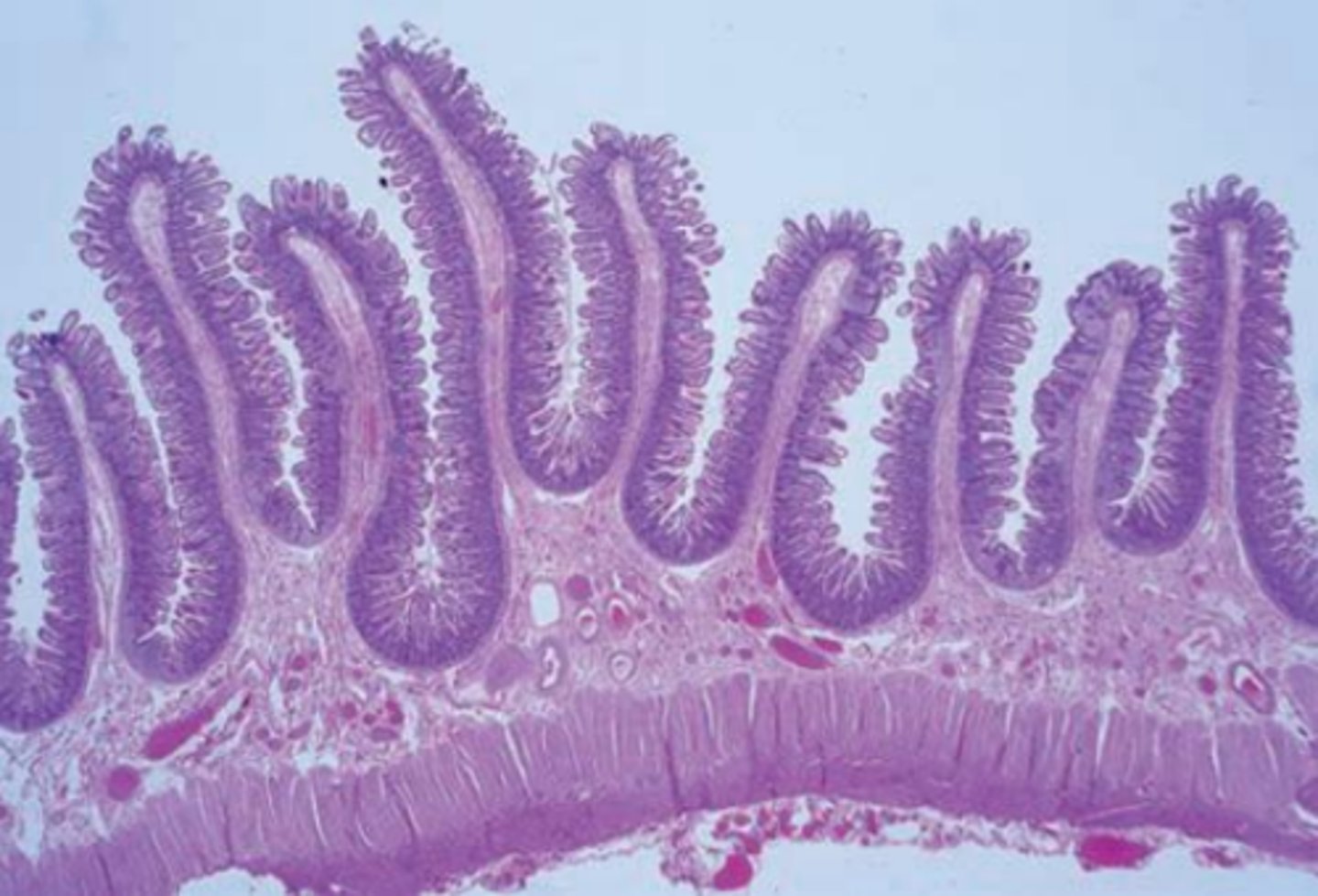<p>intestinal crypt and mucosa</p>