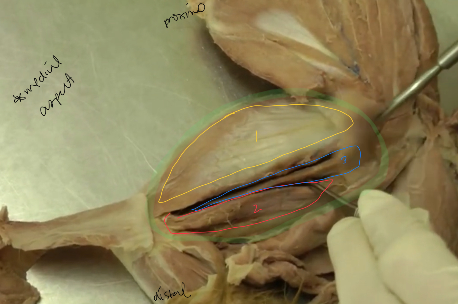 <p>what is highlighted in green?</p>