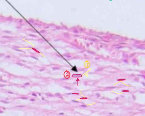 <p>Preponderant Cells: 1&amp;2</p><p>Preponderant Fiber: 3</p><p>Stain: 4</p>