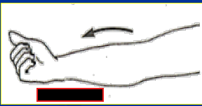 <p>What Movement is occurring?</p>