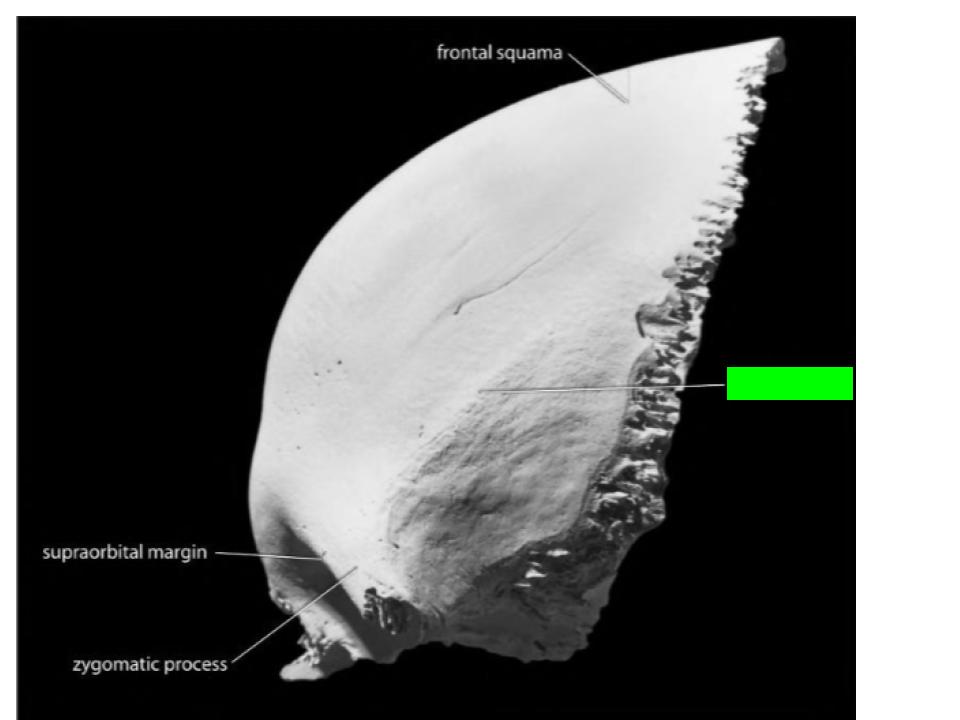 <p>What is the structure labeled in green?</p>