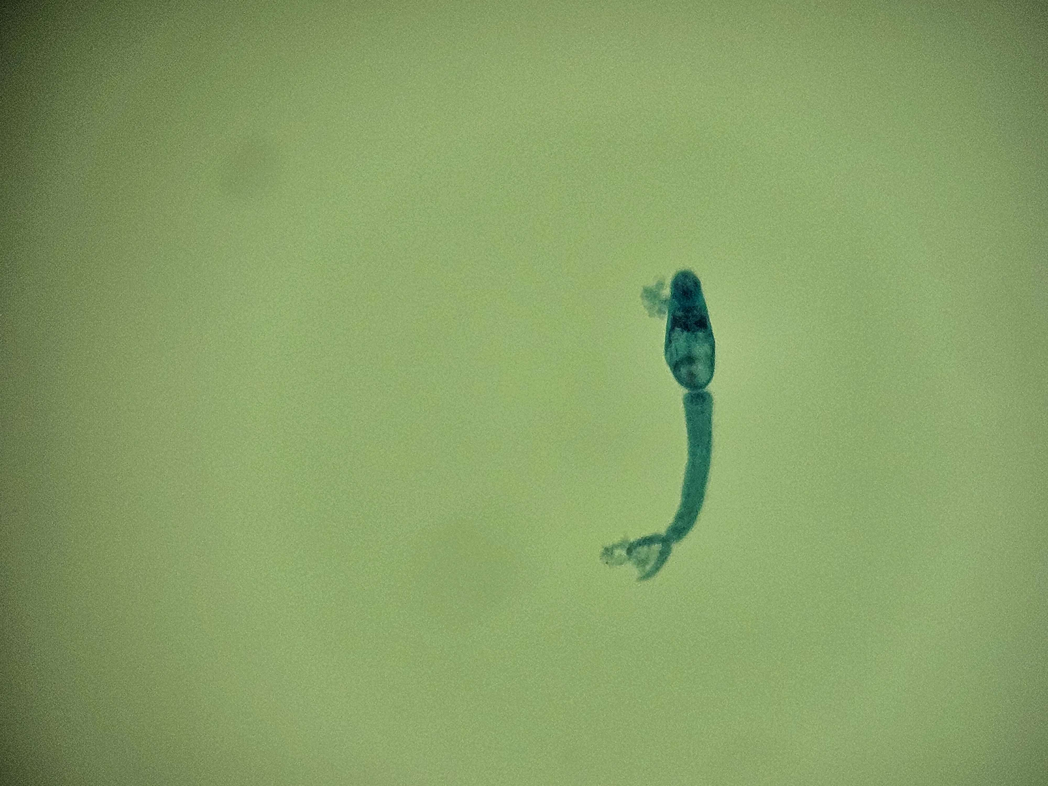 <p><span data-name="microscope" data-type="emoji">🔬</span><span data-name="petri_dish" data-type="emoji">🧫</span><strong><span> </span>Na podstawie zdjęcia preparatu:</strong></p><p></p><ul><li><p><span data-name="book" data-type="emoji">📖</span><span> </span>rozpoznaj gatunek pasożyta;</p></li></ul><p></p><ul><li><p><span data-name="recycle" data-type="emoji">♻</span><span> </span>rozpoznaj wszystkie formy rozwojowe;</p></li></ul><p></p><ul><li><p><span data-name="microbe" data-type="emoji">🦠</span><span> </span>wskaż organelle i cechy charakterystyczne dla danego gatunku;</p></li></ul><p></p><ul><li><p><span data-name="mask" data-type="emoji">😷</span><span> </span>nazwij chorobę, którą pasożyt wywołuje.</p></li></ul><p></p>