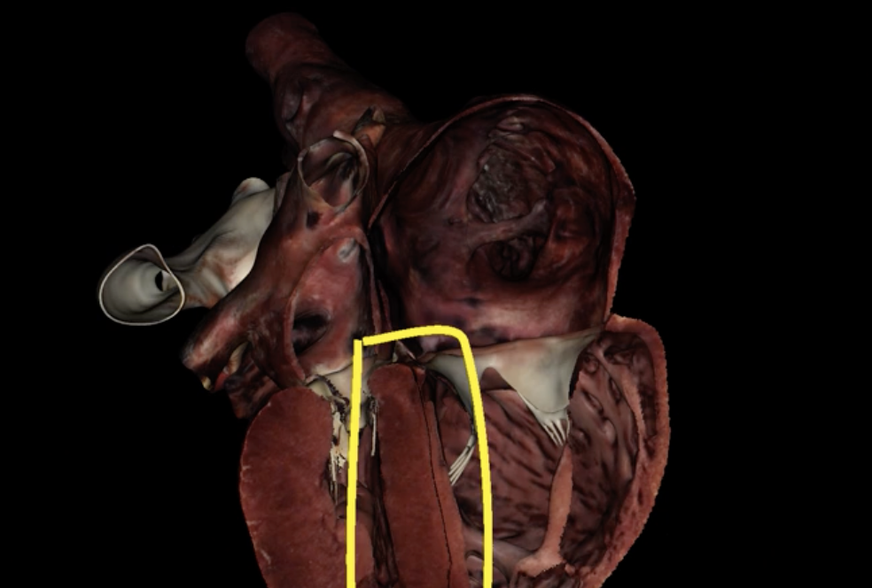 <p>What is circled in yellow?</p>