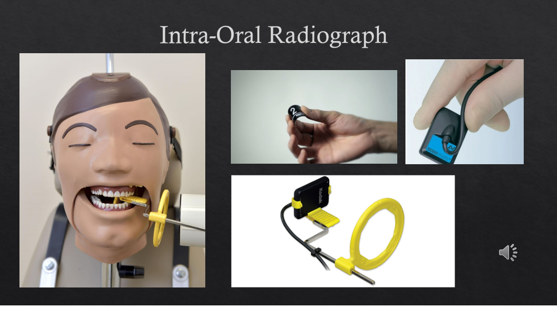 <ul><li><p>most commonly taken radiograph in dental practices </p></li><li><p>utilizes small films and can be direct digital systems or can be phosphor plates or even digital films </p></li><li><p><em>film holder - gets X ray beams to be as perpendicular as possible and the object to be as parallel as possible </em></p></li></ul><p></p>