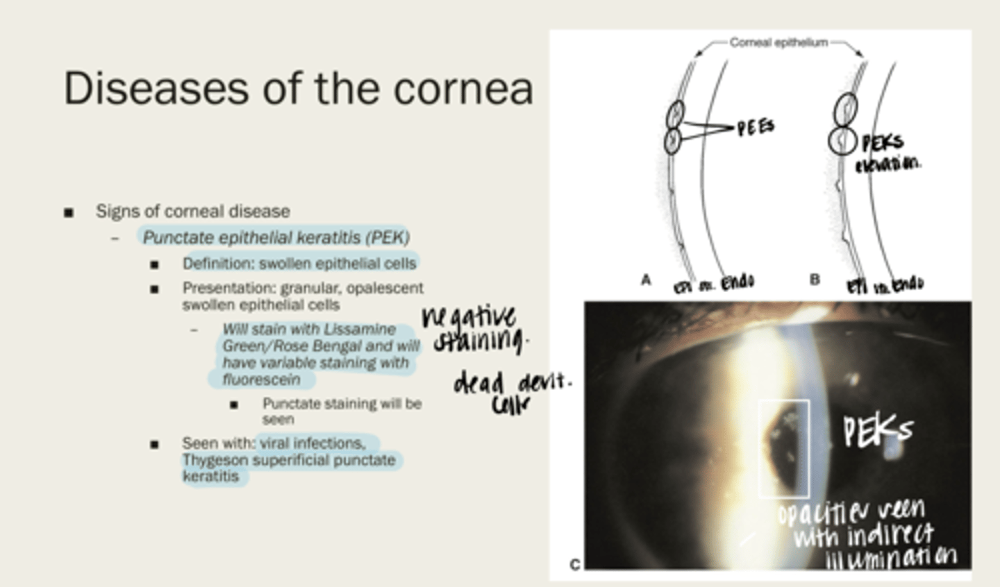 <p>What is the presentation of punctate epithelial keratitis (PEK)?</p>