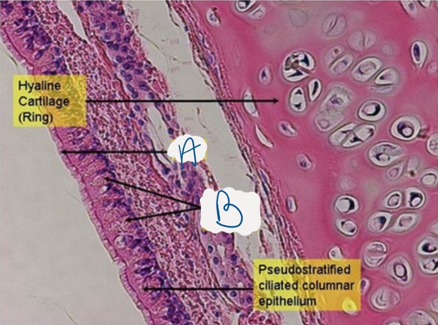 <p>What structure of the trachea is indicated by A</p>