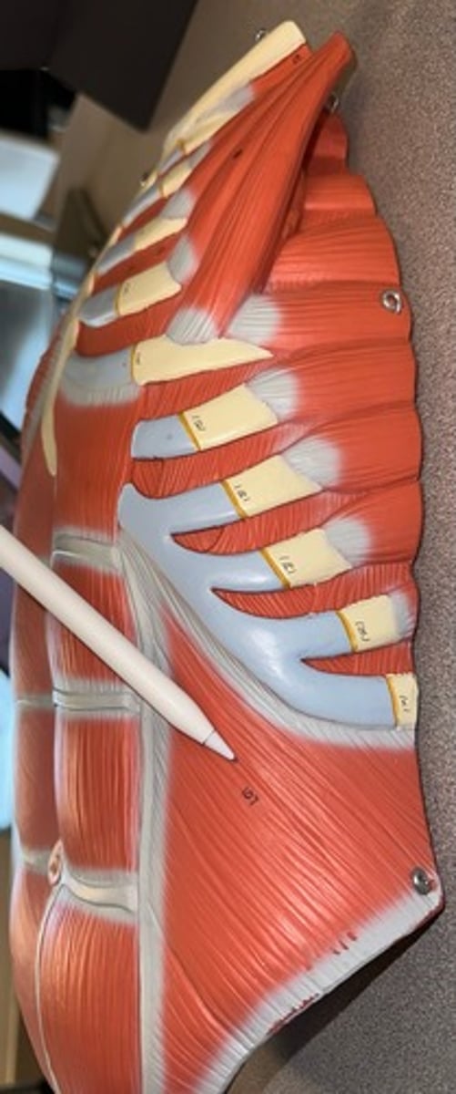 <p>What are the (5) attachments of the Internal Abdominal Oblique?</p>