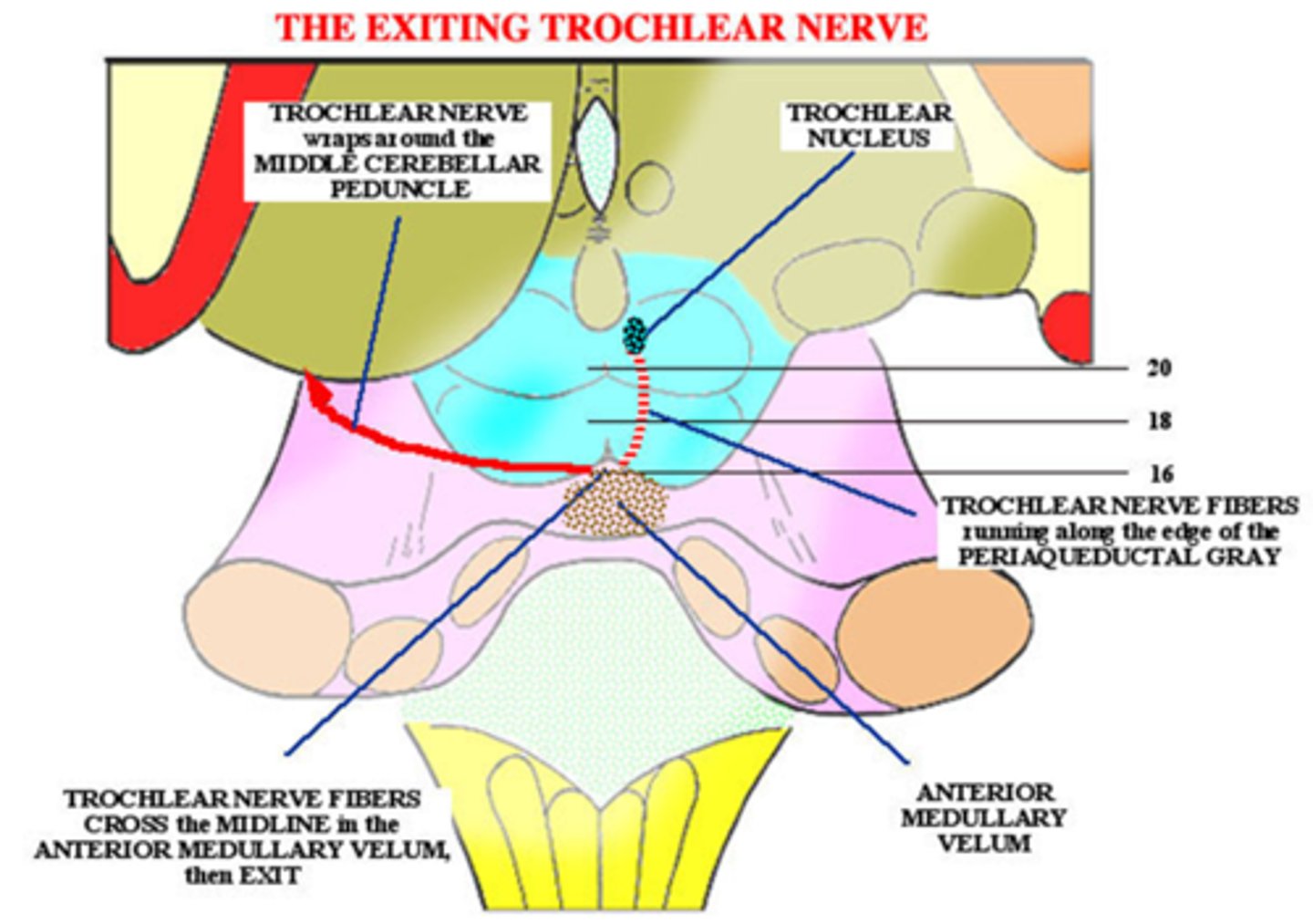 <p>head trauma</p>