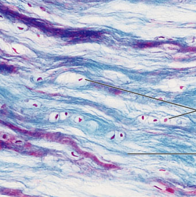 <p>Fibrocartilage</p>