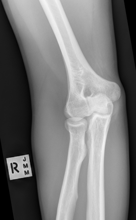 <p>What position is demonstrated?</p>