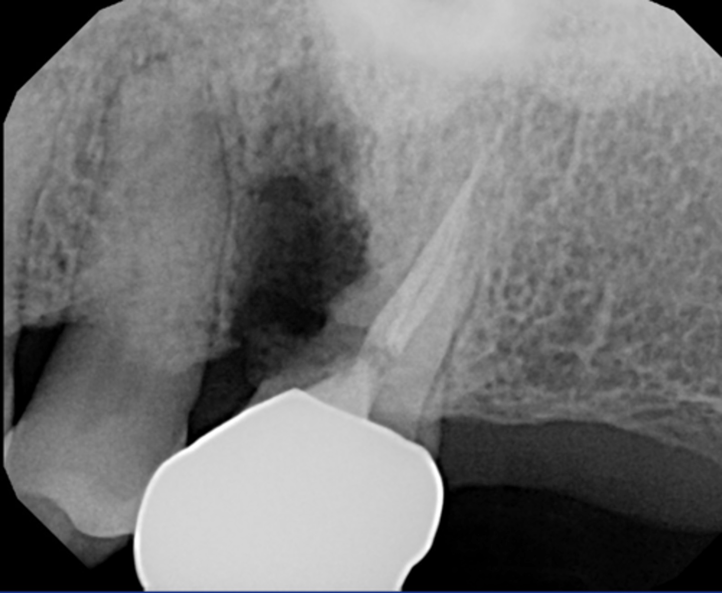 <p>ID the surgical procedure:</p>