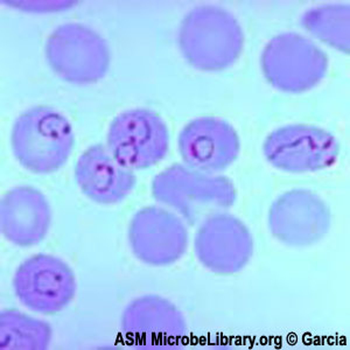 <p>(2) malarial parasite</p><p>ring forms: ring with TWO CHROMATIN DOTS; APPLIQUE forms present</p><p>trophozoite: small COMPACT ring with cytoplasmic VACUOLATION</p><p>schizont: NEARLY fills RBC</p><p>gametocyte: crescent, sausage, banana-shaped</p>